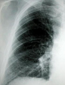 especialidad broncopulmonar