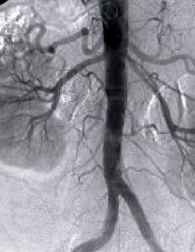 hemato oncologia