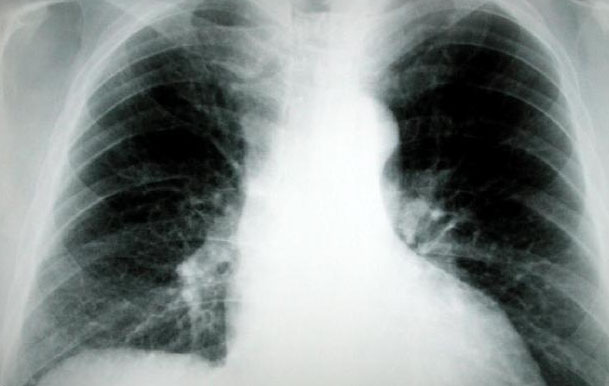 especialidad broncopulmonar